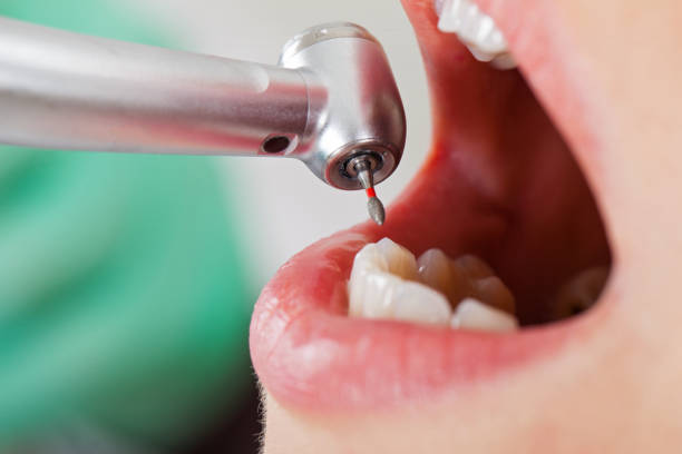 Best Emergency Pediatric Dentist  in Ettrick, VA